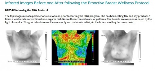 Breast Health improved through nutrition.